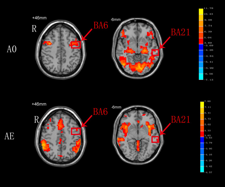 FIGURE 4