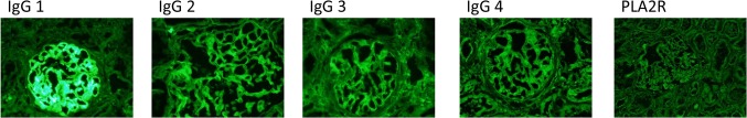 Fig. 2