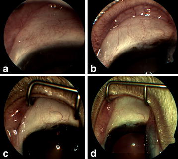 Fig. 2