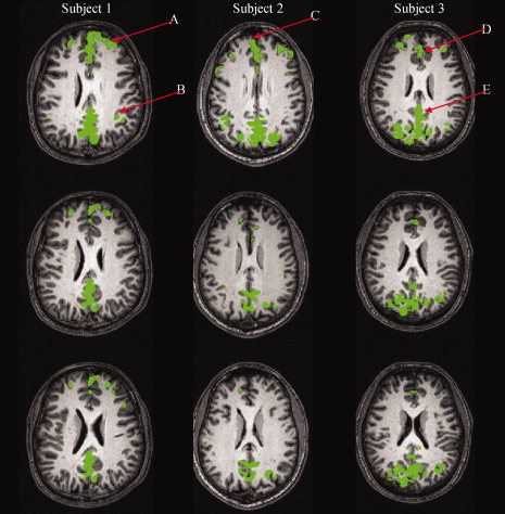 Figure 12