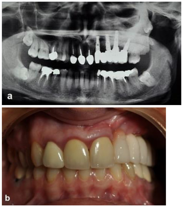 Figure 9