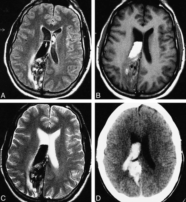 fig 2.