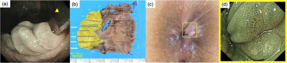 FIGURE 3