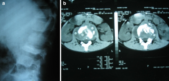 Fig. 1