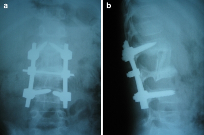 Fig. 2