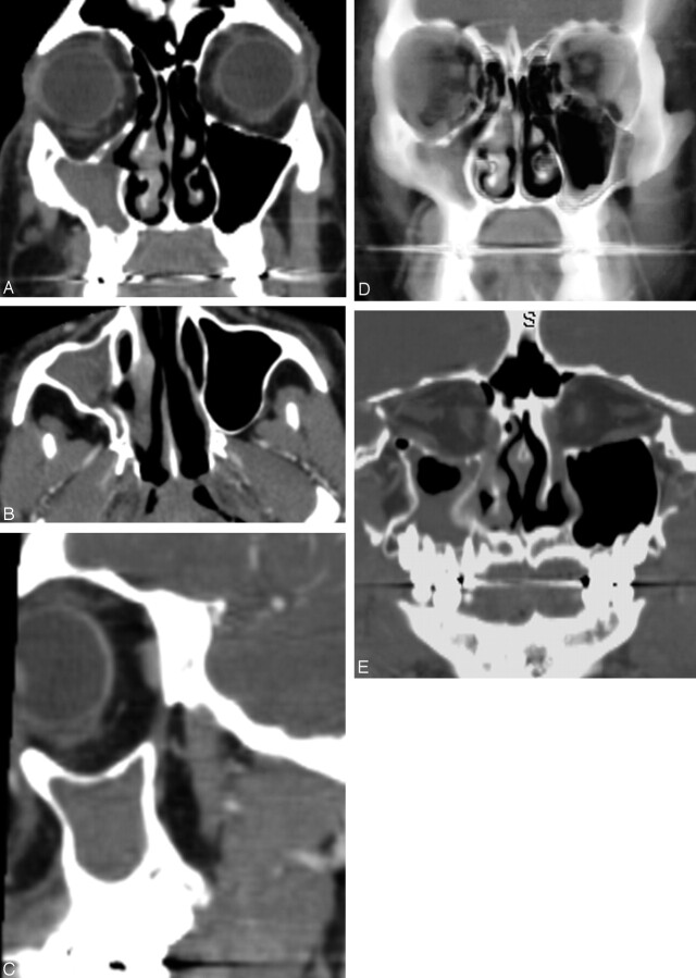 Fig 1.