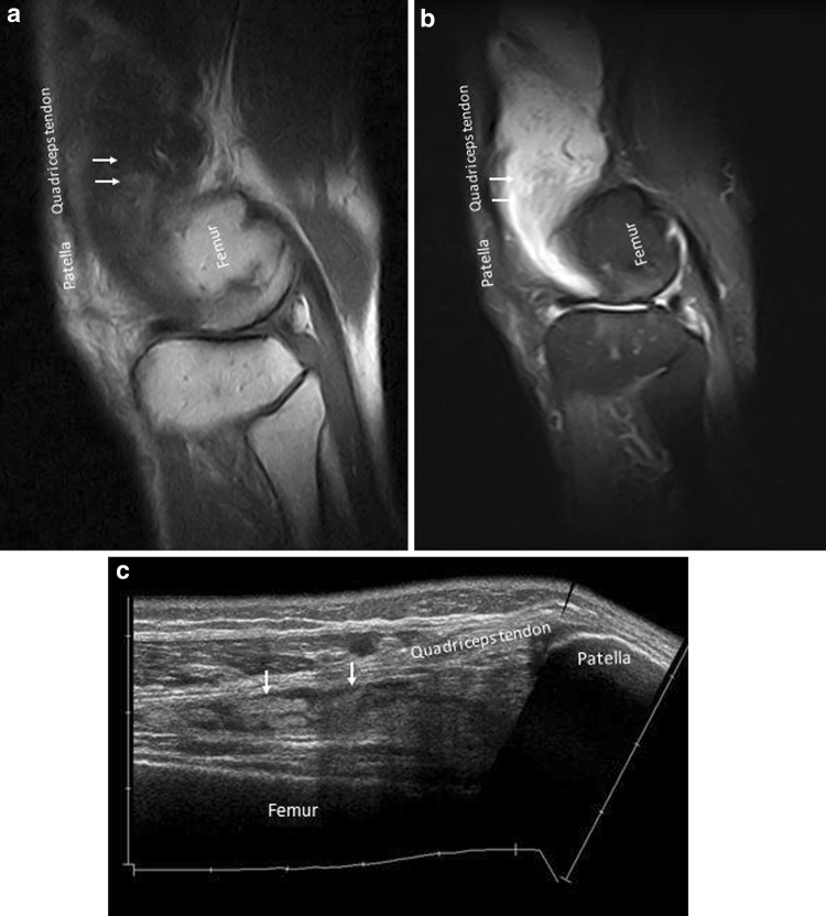 Fig. 11