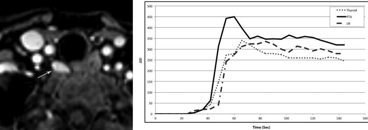 Fig 2.