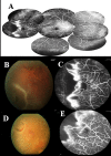 Fig 4