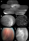 Fig 3