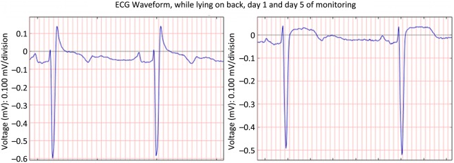 Figure 4