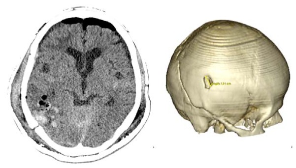 Figure 6.