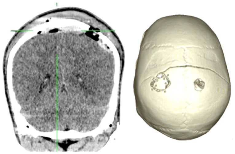 Figure 2.