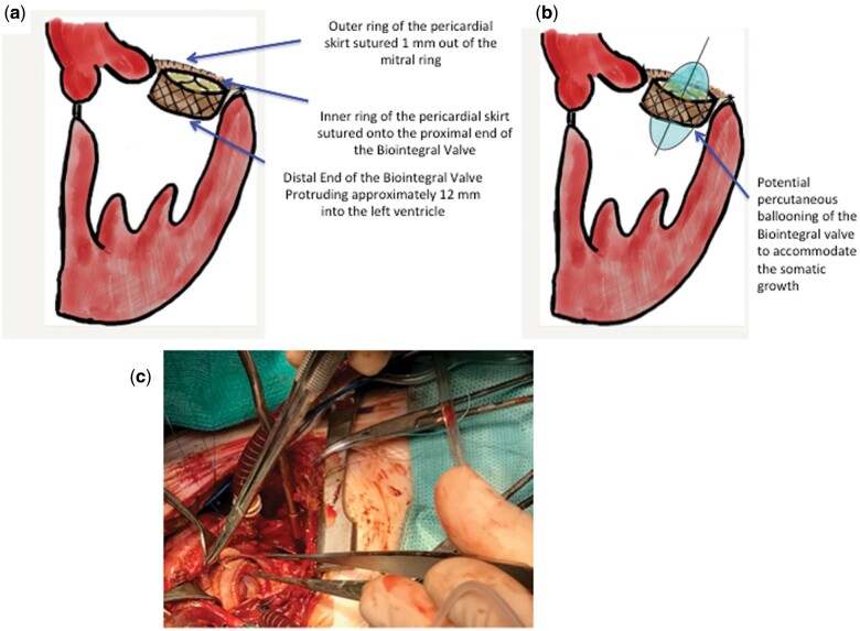 Figure 2: