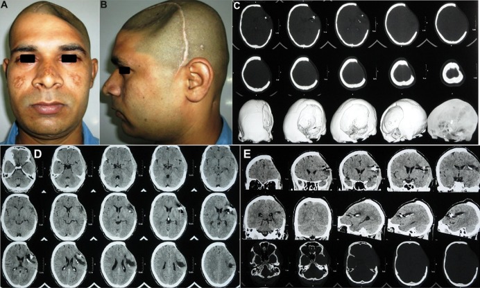 Fig. 20