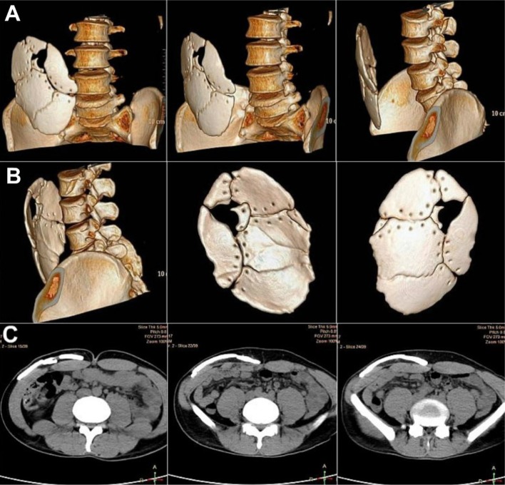 Fig. 16