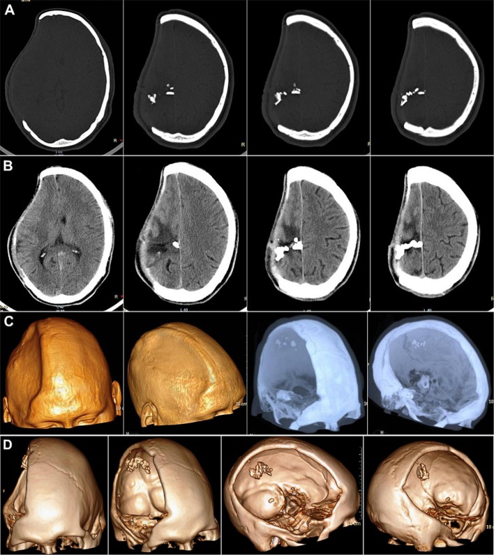 Fig. 15