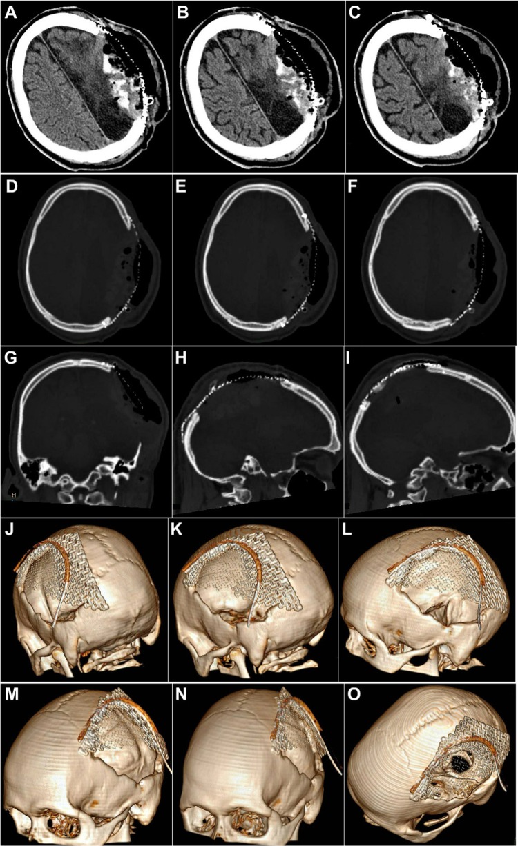 Fig. 22