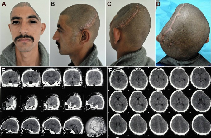 Fig. 1