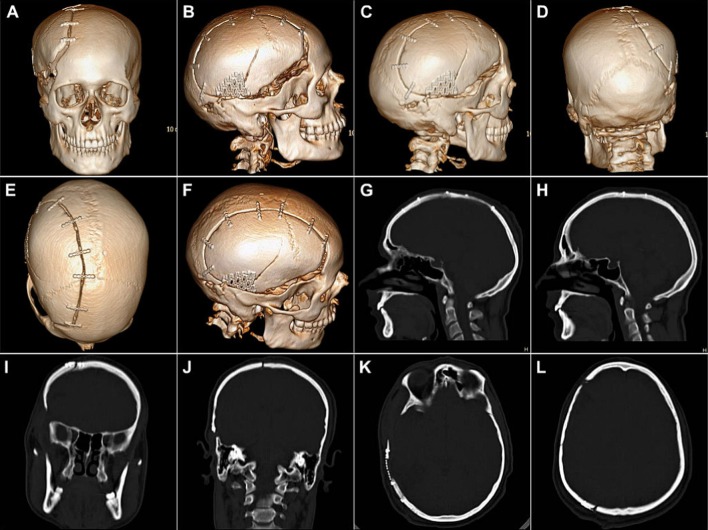Fig. 11
