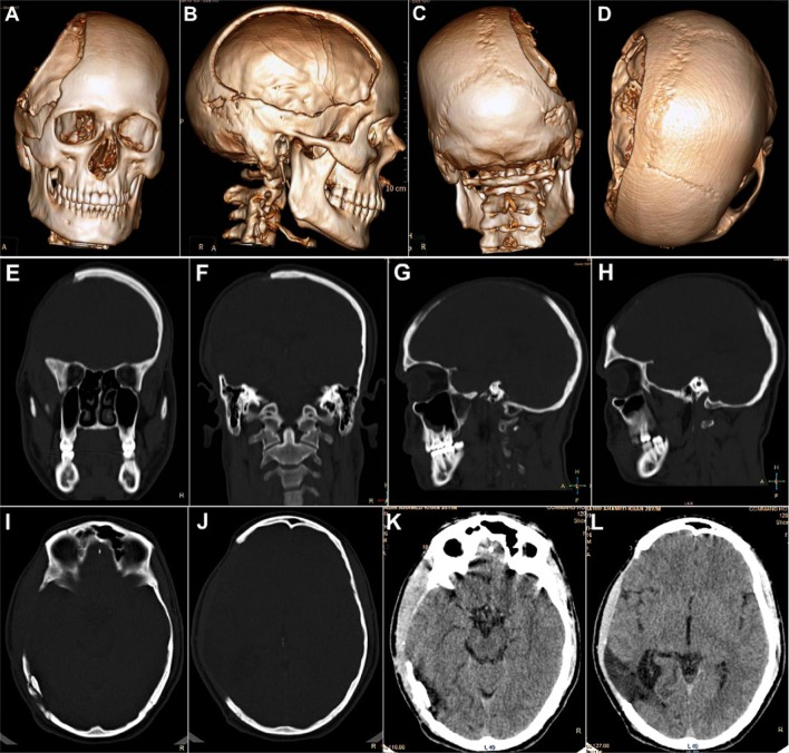 Fig. 8