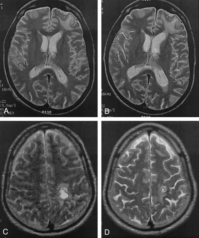 Fig 1.