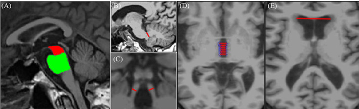 FIG 1