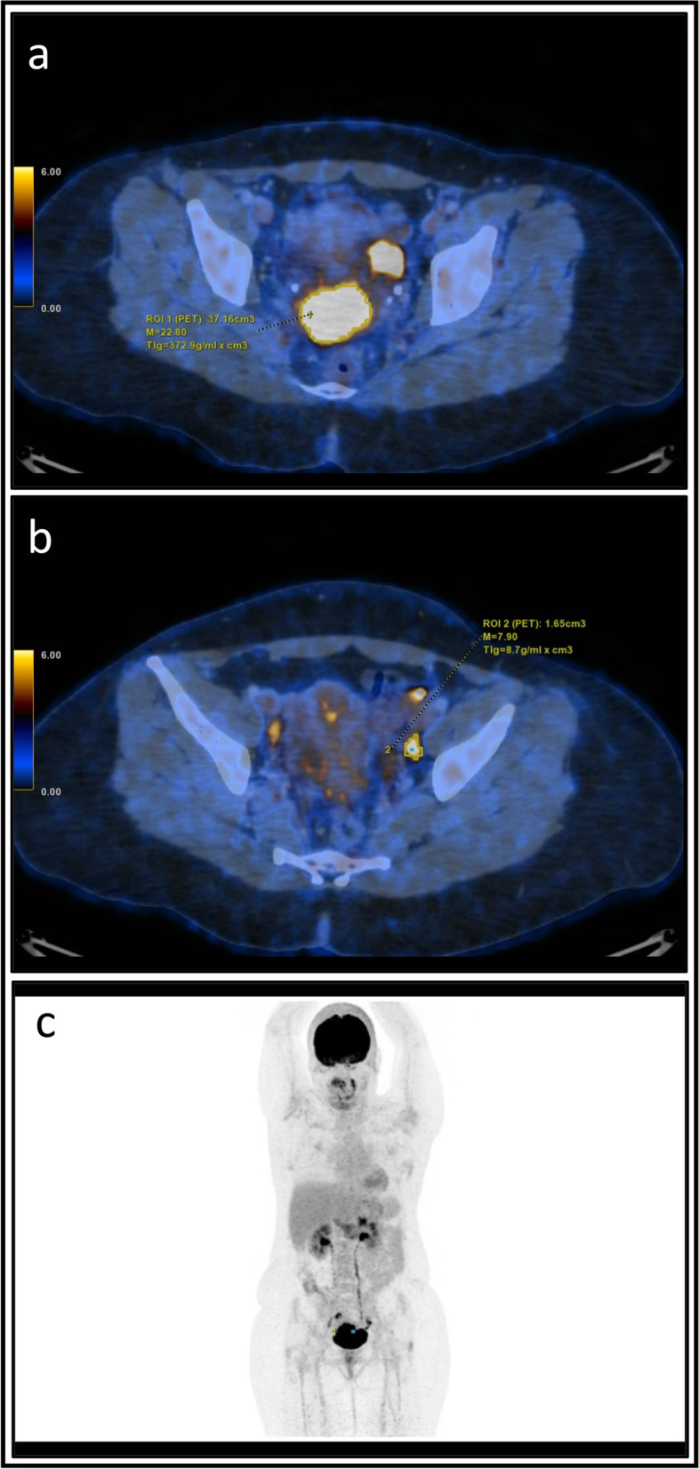 Fig. 2