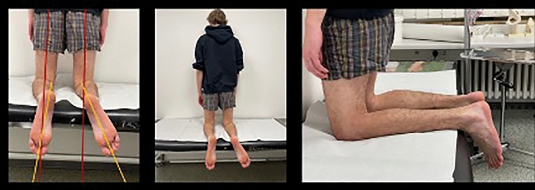 Fig. 4