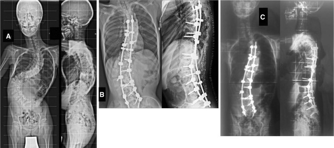 Fig. 1