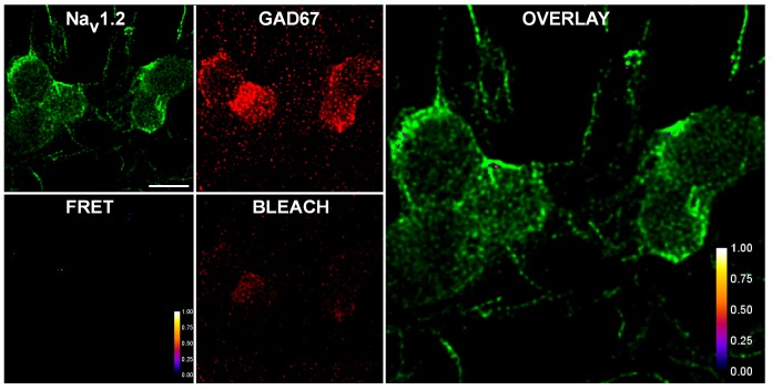 Figure 2—figure supplement 1.