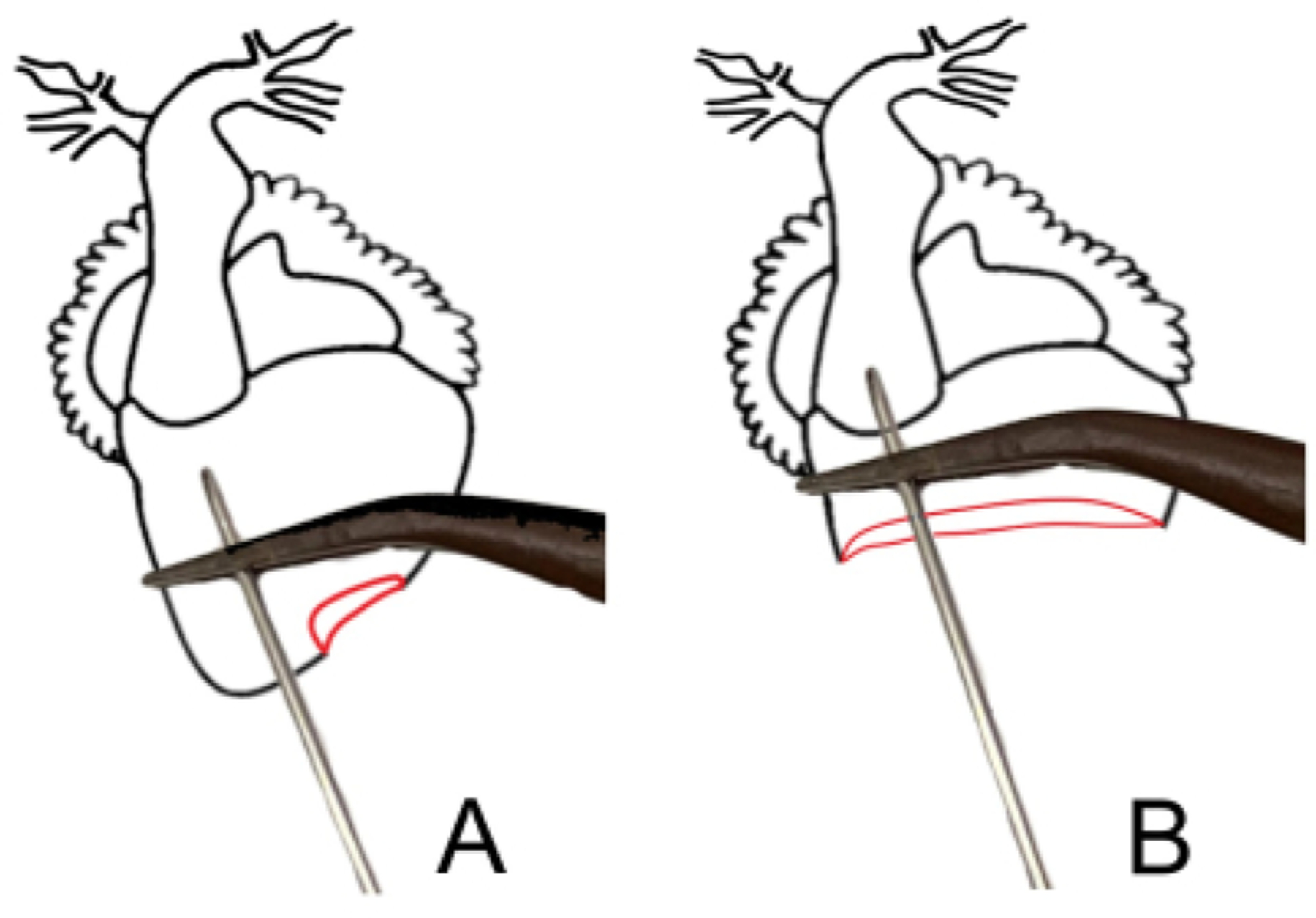 Figure 11: