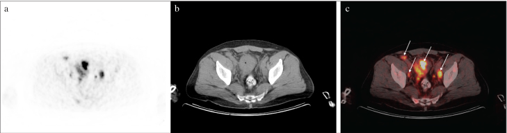 Figure 1. a–c