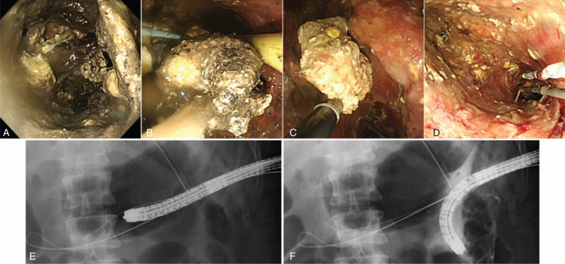 FIGURE 3