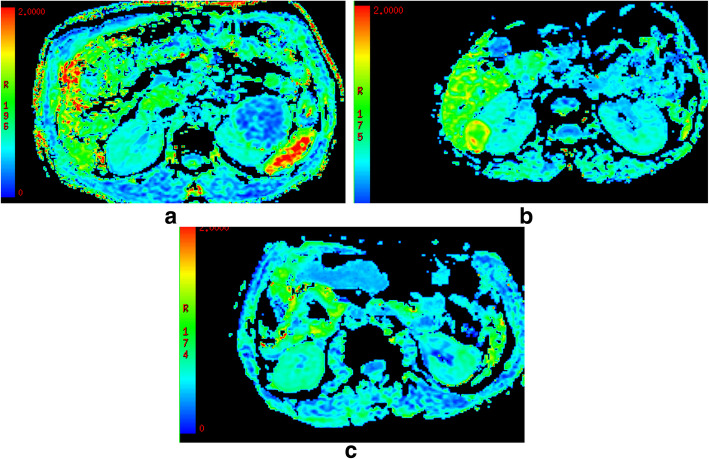 Fig. 2