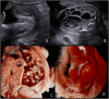 Fig. 9