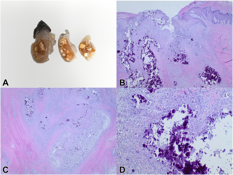 Figure 1