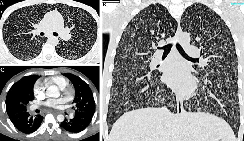 Figure 28