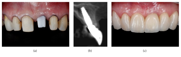 Figure 10