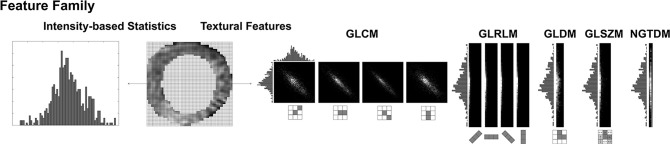 Examples of radiomic features extracted from cardiac MR images (T1 mapping in this example) in a 62-year-old female patient by using PyRadiomics. (a) Cardiac MR image and the manually delineated ROI were given as inputs, and image filters were applied on the original image to create additional radiomic features. (b) A total of 1023 features were extracted from various feature families. GLCM = gray-level co-occurrence matrix, GLDM = gray-level dependence matrix, GLRLM = gray-level run length matrix, GLSZM = gray-level size-zone matrix, LBP = local binary pattern, NGTDM = neighboring gray-tone-difference matrix, ROI = region of interest, wavelet-HH = wavelet high-pass filter applied in horizontal and vertical directions, wavelet-HL = wavelet high- and low-pass filters applied in horizontal and vertical directions, wavelet-LH = wavelet low- and high-pass filters applied in horizontal and vertical directions, wavelet-LL = wavelet low-pass filter applied in horizontal and vertical directions.