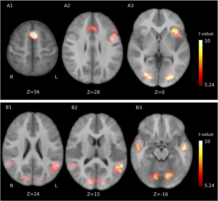 Fig. 2