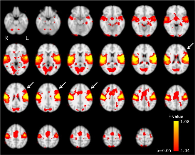 Fig. 3