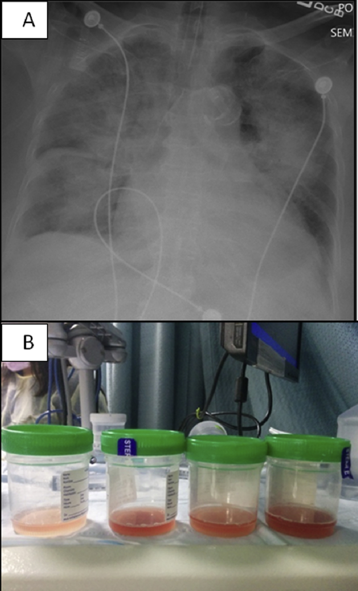 Fig. 2