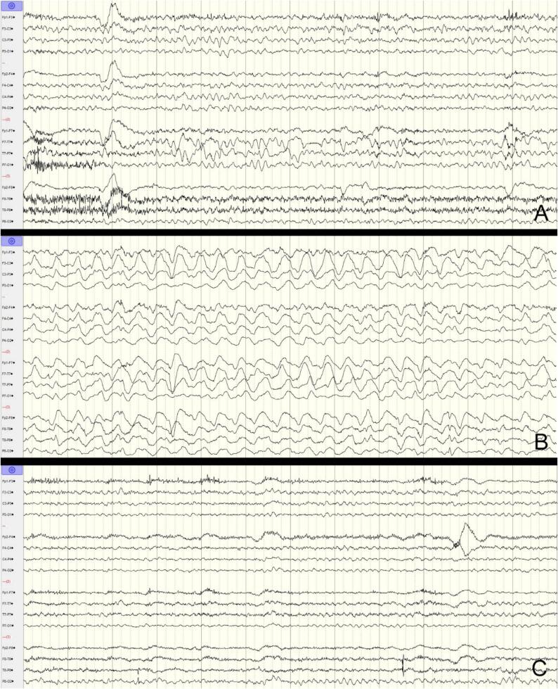 Fig. 2