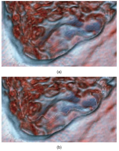 Fig. 5