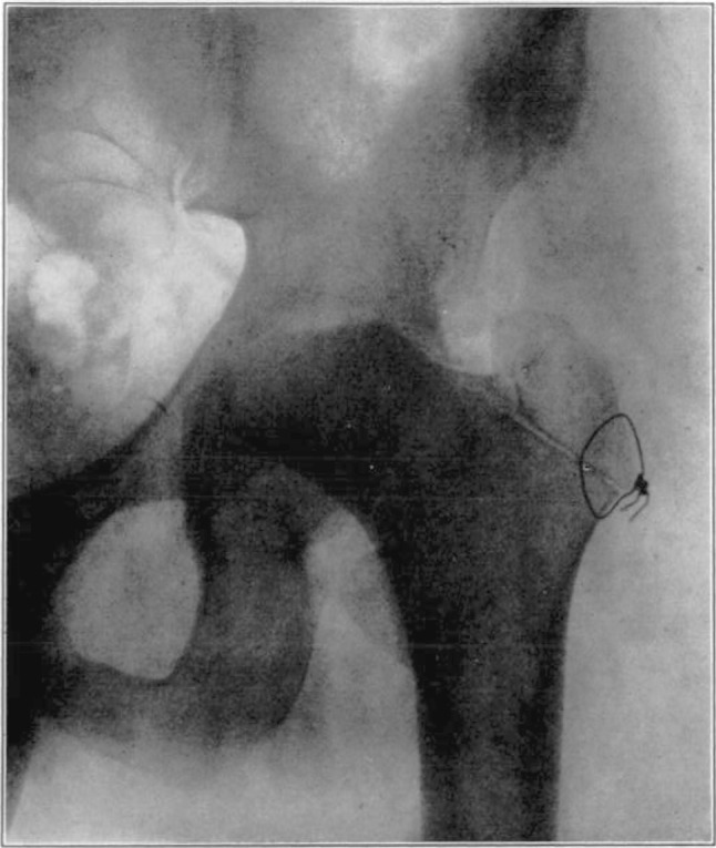 Fig. 2