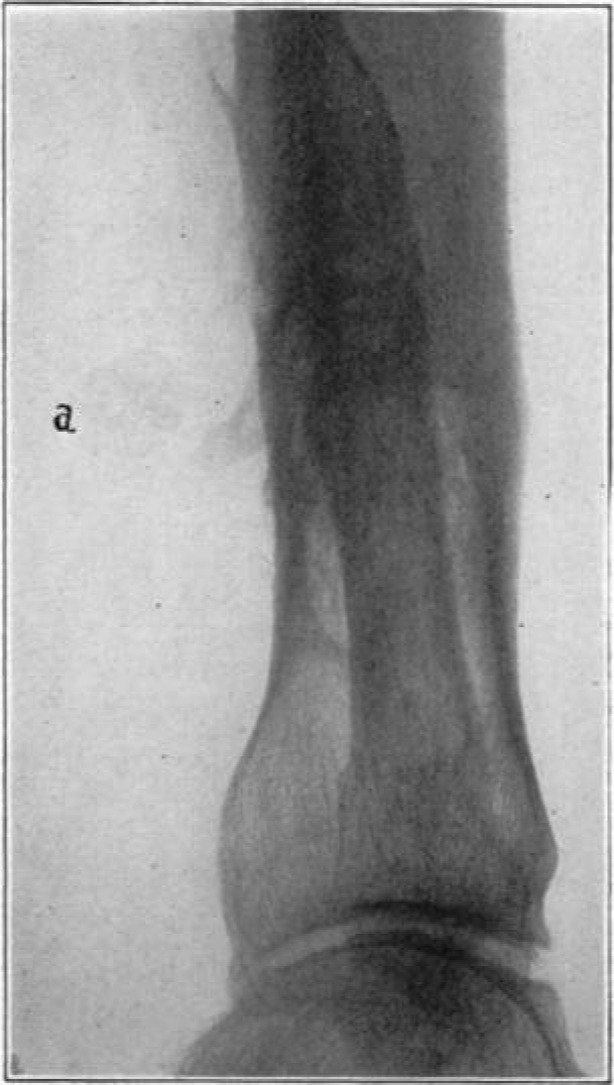 Fig. 15