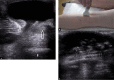 Fig. 12.