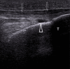 Fig. 17.