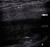 Fig. 11.